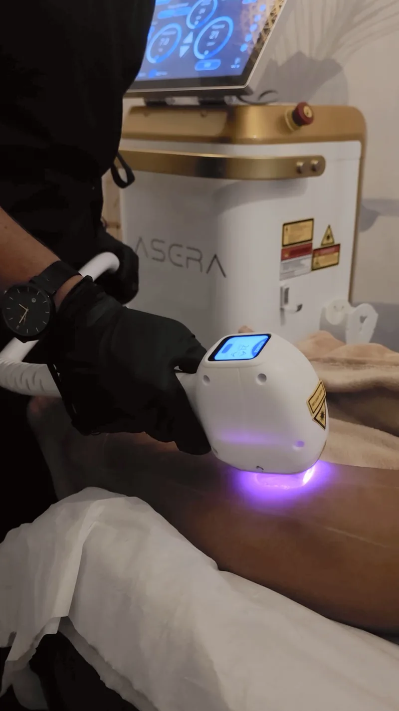 Laser